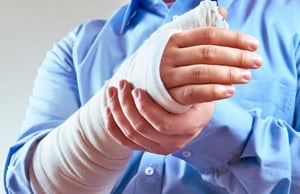 arm in a cast
