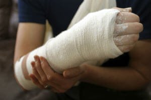 broken arm in a cast