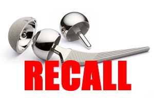 hip implant recall