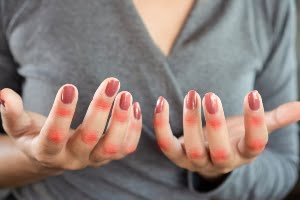Someone having pain in their hand,