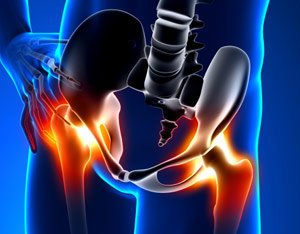 X-ray style illustration highlighting inflammation and pain in the hip and pelvic joints in red and orange hues.